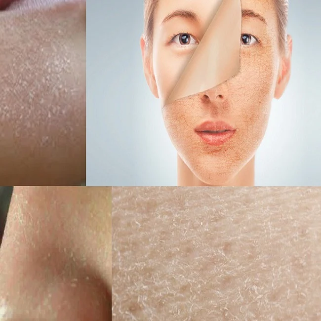 Hydrating serum